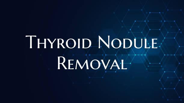 Thyroid Nodule Removal