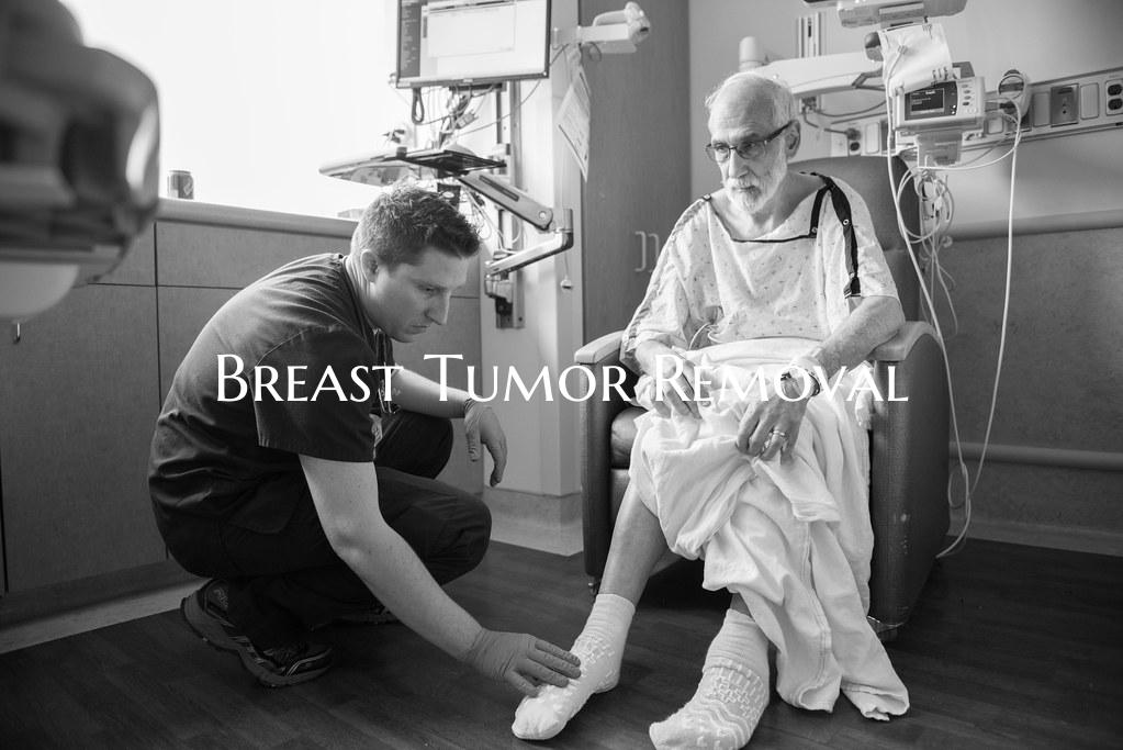 Breast Tumor Removal