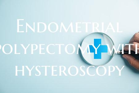 Endometrial polypectomy with hysteroscopy