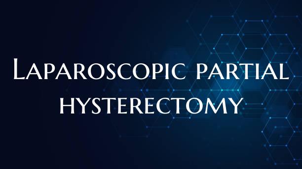 Laparoscopic partial hysterectomy