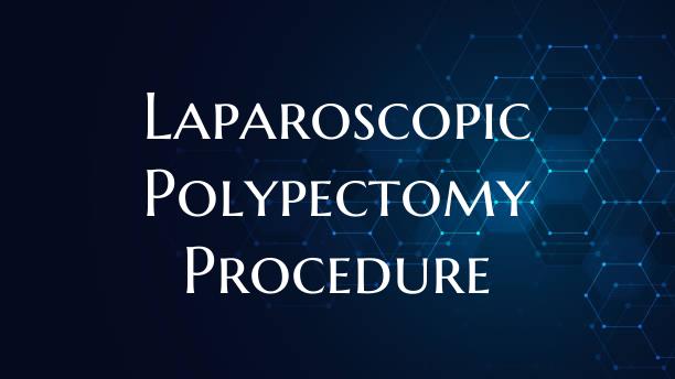Laparoscopic Polypectomy Procedure